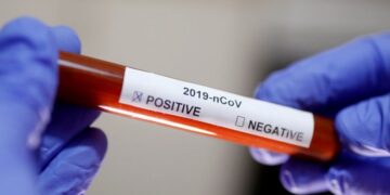 Epidemiologu tregon si do të kryhet testimi i shpejtë për COVID-19: Përgjigjja del në 30 minuta