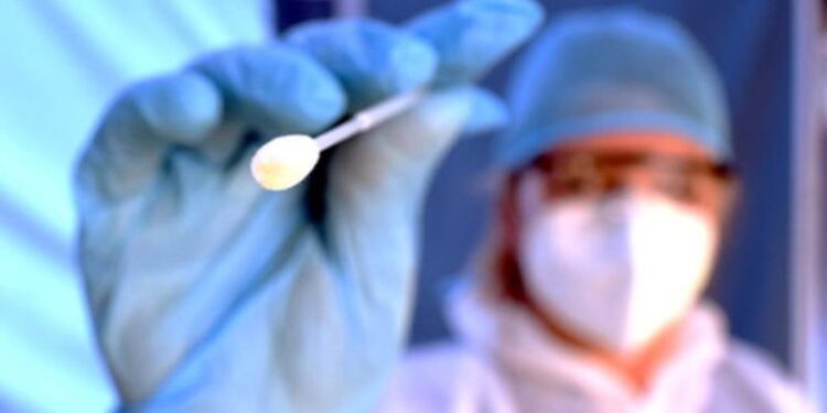 Sërish shifra në ulje/ Raportohen 503 raste të reja dhe 6 humbje jete në 24 orët e fundit me Covid 19