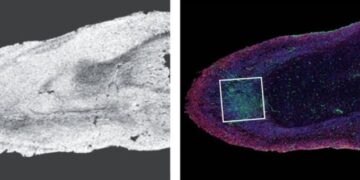 Shkencëtarët zbulojnë dëmin që mund të shkaktojë Covid-19 në trurin e njeriut