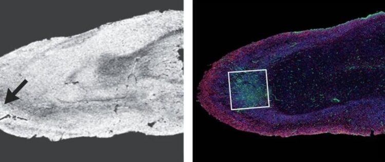 Shkencëtarët zbulojnë dëmin që mund të shkaktojë Covid-19 në trurin e njeriut
