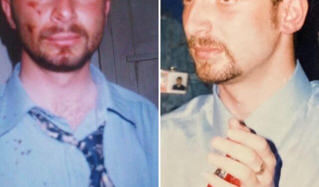 “Sali Berisha shihe krimin tënd në fytyrën time”, Erion Braçe publikon fotot që po ‘thyejnë’ rrjetin dhe shpërthen i revoltuar: Asgjë nuk harrohet! Kryetari i PS në burg dhe…