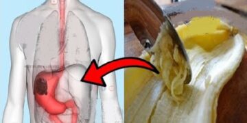 Si nuk e paskemi ditur më parë?! Bananet kanë aftësinë të kurojnë këto probleme shëndetësore mjaft të përhapura
