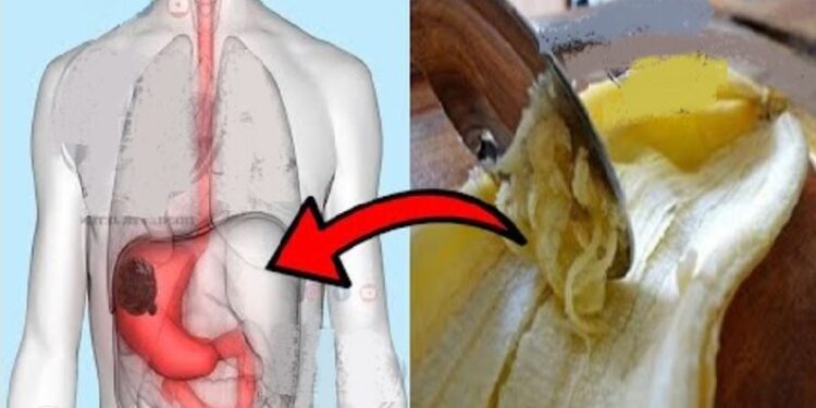 Si nuk e paskemi ditur më parë?! Bananet kanë aftësinë të kurojnë këto probleme shëndetësore mjaft të përhapura
