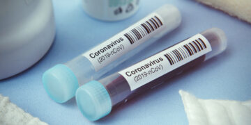 Kush ka bërë vaksinën mos të harxhoj para nëpër klinika për të bërë testin serologjik, nuk janë efektive