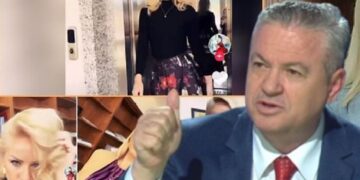 Kërkesa e pazakontë e deputetit: Të bëhet një raport për qejflinjtë e botoksit, ka 13 gjyqtare me fryrje buzësh e rregullim karabinaje