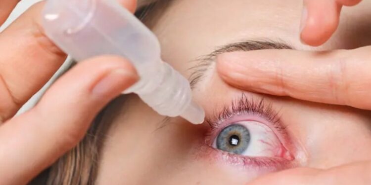 Keni irritim të syve? Provoni këto mënyra natyrale për t’i trajtuar