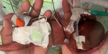 Mbijeton foshnja më e vogël në botë, lindi 132 ditë para datës normale