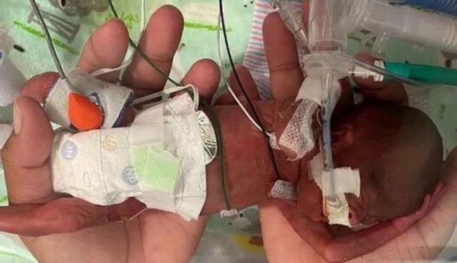 Mbijeton foshnja më e vogël në botë, lindi 132 ditë para datës normale