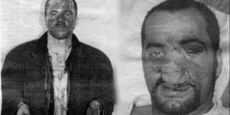 25 vite nga dhuna ndaj Edi Ramës! Gazetat e kohës: Goditet për vdekje nga falangat e pushtetit të PD! Ishte duke shkruar kundër Berishës