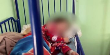 Skandali i “Gjirofarm” me kosin dhe nënproduktet me fekale të kafshëve, ja çfarë sëmundjesh shkakton “enterobakteri” tek njerëzit