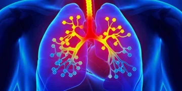 Shenjat treguese që e ftohura ka kaluar në bronkit, kurat natyrale