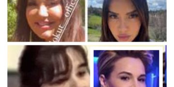 Vetëm Megi Pojani i afrohet Monika Kryemadhit për restaurim fytyre: Ja si i kanë shfryrë faqet! Mona: Bukurinë e kam natyrale