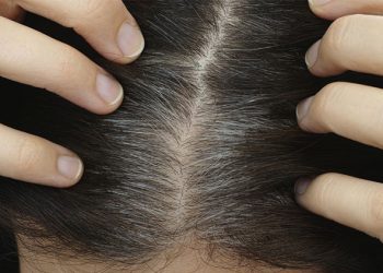 Shkencëtarët zbulojnë arsyen e thinjave në flokë! Ju mund të mësoni se si mund ta evitoni