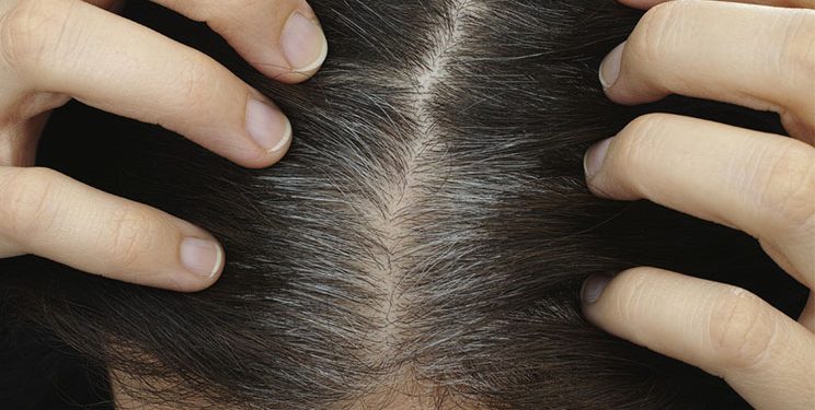 Shkencëtarët zbulojnë arsyen e thinjave në flokë! Ju mund të mësoni se si mund ta evitoni